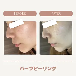 メンズ キッズ Amaryllis 🌹松本のエステ・リラクイメージ