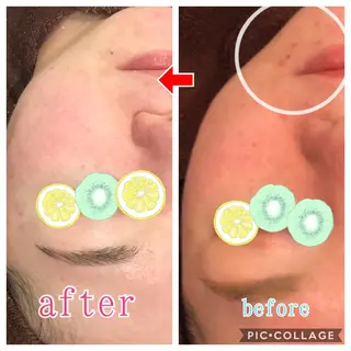 セミロング カラー パーマ ヘアアレンジ メンズ キッズ ネイル マツエク・マツパ 四つ星サロン🎖 腸＆ニキビケアに特化のエステ・リラクイメージ