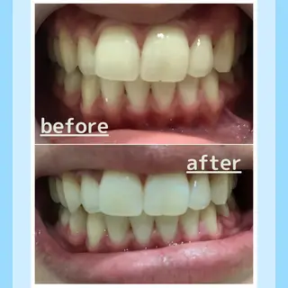 メンズ お手軽ホワイトニングsalon mina所属・武元 奈津美のその他イメージ