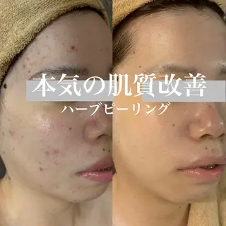 WHITE AQUA 北千住店のエステ・リラクイメージ