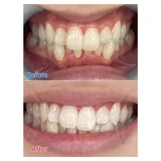 MBEAUTYSALON 千葉店・京成大久保所属・Melty 輝のその他イメージ