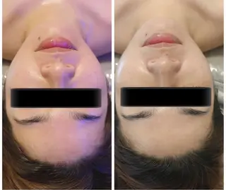 esthesalon Ran所属・小顔美肌痩身サロン Ranのその他イメージ