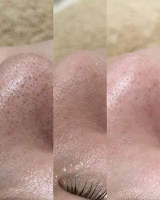 Liber Kyoto所属・魔法のシミ取り職人 CHIKAのマツエク・マツパデザイン