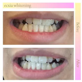 セルフホワイトニング エクシア五反田店のその他イメージ