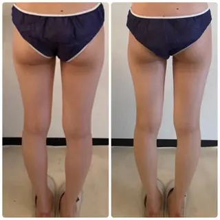 FLEUR大阪・整体 ・ハイフ・痩身・小顔のエステ・リラクイメージ