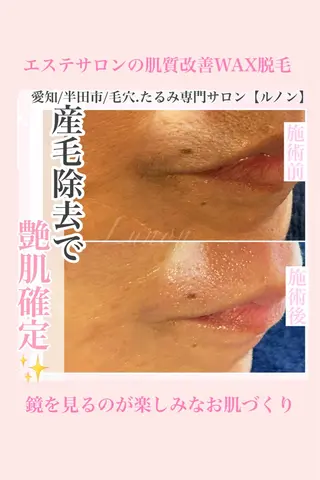 毛穴.たるみ専門店 Lunonのエステ・リラクイメージ