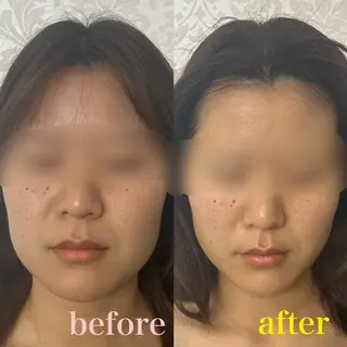 フェイシャルサロン CHIARA 荒田のエステ・リラクイメージ