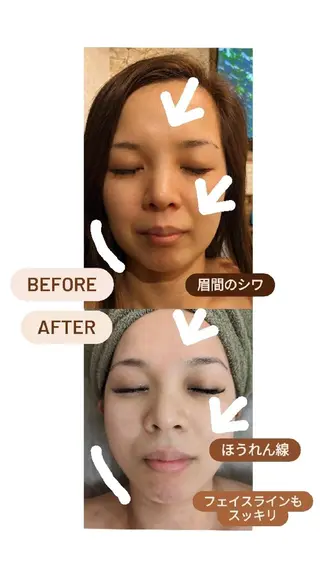 プライベートサロン宿り木所属・江坂@宿り木 脱毛& 耳ツボジュエリーのその他イメージ