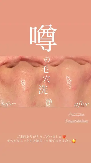 La・Bellvie所属・La･Bellvie 【星ヶ丘店]のエステ・リラクイメージ