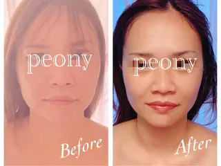 デトックス美容専門サロンpeony所属・デトックス美容専門 サロンpeonyのエステ・リラクイメージ