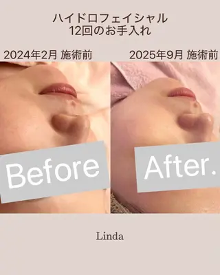 アイラッシュ&エステサロンLinda西宮所属・小顔&肌質改善 LINDA西宮 AIのエステ・リラクイメージ