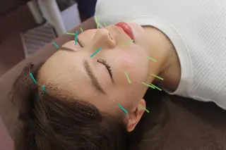 同心整骨院 美容鍼・整体・小顔のエステ・リラクイメージ