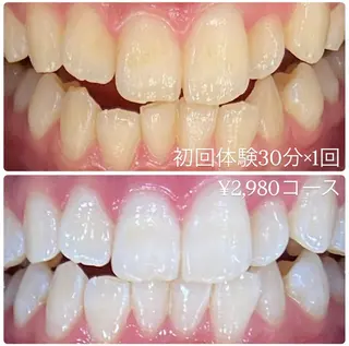 PLATINUM Beauty 横浜店所属・ホワイトニングルーム 横浜店のその他イメージ