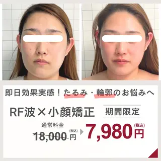 小顔矯正専門店 【RED】池田のエステ・リラクイメージ