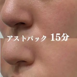 憧れの韓流すっぴん肌 🤎肌管理専門エステのエステ・リラクイメージ