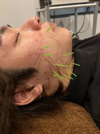 メンズ 美容鍼灸サロン LOMIHARIのエステ・リラクイメージ