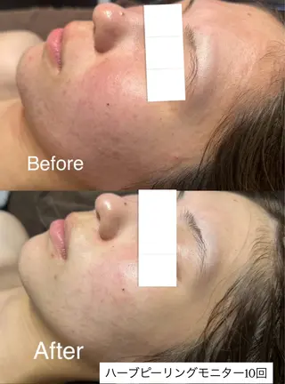 One'Ness total beauty salon所属・One' Nessのエステ・リラクイメージ