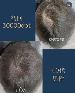 メンズ W eye+東口店/ SCALP INKのマツエク・マツパデザイン