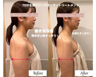 痩身×フェイシャル ブライダル|Linoのエステ・リラクイメージ