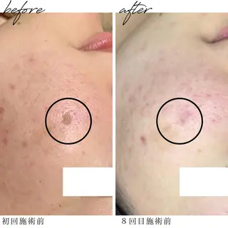 最新シミケアLily de pearlのエステ・リラクイメージ