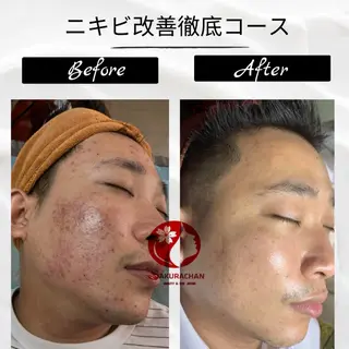 ニキビ、痩身、脱毛、 サクラチャンスパのエステ・リラクイメージ