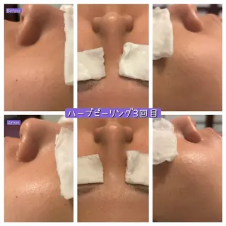 ぱんだ王国エステ所属・ぱんだ王国 エステのエステ・リラクイメージ