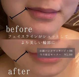 NICOLAUGH/ 村松【小顔.ボディ】のエステ・リラクイメージ