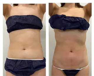 ブライダル痩身×脱毛 尼崎駅前サロンのエステ・リラクイメージ