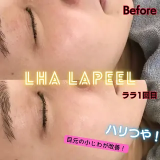 天神 MeMeのエステ・リラクイメージ