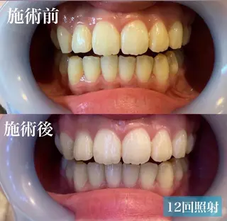 ヘアアレンジ メンズ ネイル マツエク・マツパ アイブロウ LBSホワイトニング 銀座店💎公式のその他イメージ