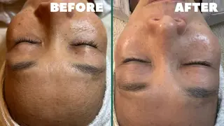 esty hitomiのエステ・リラクイメージ