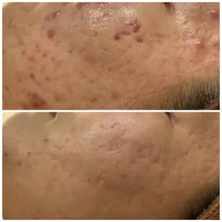 触れたくなる モテ肌へ...❤︎のエステ・リラクイメージ