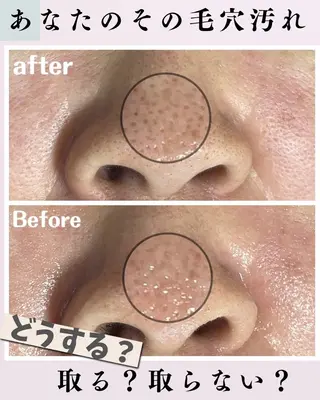 肌質改善サロン facialmoonのエステ・リラクイメージ