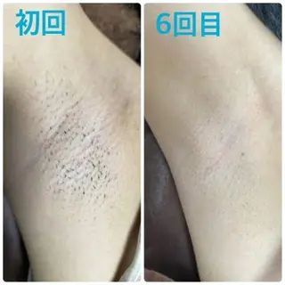 美肌脱毛専門サロン muro.のエステ・リラクイメージ