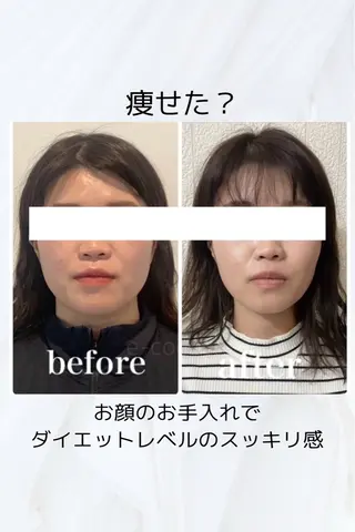 小顔と ヘッドスパのお店のエステ・リラクイメージ