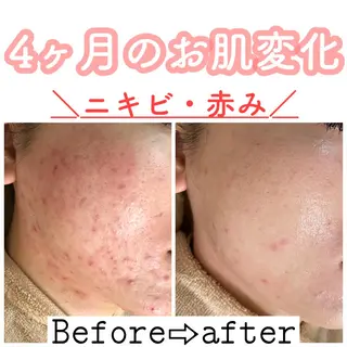 ショート カラー パーマ ヘアアレンジ メンズ キッズ ネイル マツエク・マツパ ニキビ&跡改善サロン オーナー光木のエステ・リラクイメージ