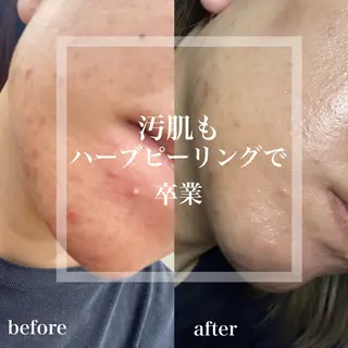 WHITE AQUA 北千住店のエステ・リラクイメージ