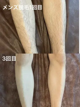 プライベート脱毛 Jr久宝寺のエステ・リラクイメージ