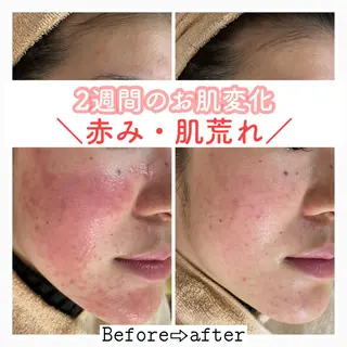 ショート カラー パーマ ヘアアレンジ メンズ キッズ ネイル マツエク・マツパ ニキビ&跡改善サロン オーナー光木のエステ・リラクイメージ