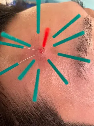 小顔美容鍼専門サロン 渋谷YZのエステ・リラクイメージ