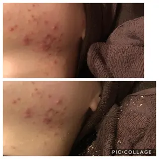 セミロング カラー パーマ ヘアアレンジ メンズ キッズ ネイル マツエク・マツパ 四つ星サロン🎖 腸＆ニキビケアに特化のエステ・リラクイメージ