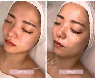 beauty salon Clochette所属・clochette misakoのエステ・リラクイメージ