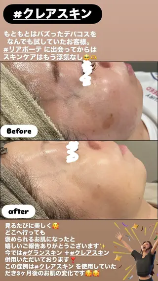 LiZA エステティックサロンのエステ・リラクイメージ