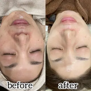 laluna saki...のその他イメージ