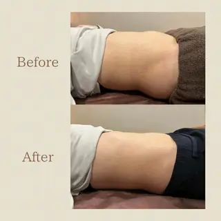 お腹痩せエステ Flat BELLY 恵比寿所属・【腸もみ/脂肪冷却】 お腹エステ/恵比寿のエステ・リラクイメージ