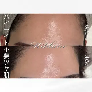 肌質管理 MIBLANC上野店のその他イメージ