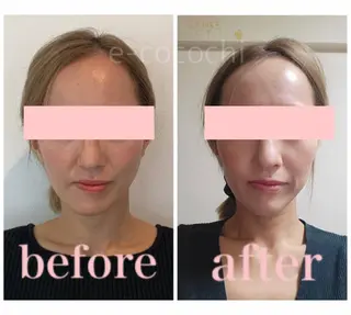 小顔と ヘッドスパのお店のエステ・リラクイメージ