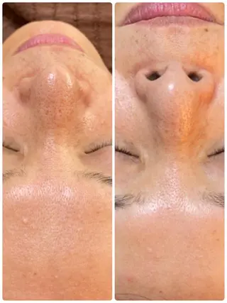 サロンドプララン所属・サロンド プラランのエステ・リラクイメージ