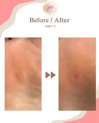 フットケアサロン miraiのその他イメージ