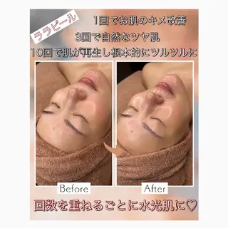 WhiteAqua 博多店　Erikoのエステ・リラクイメージ